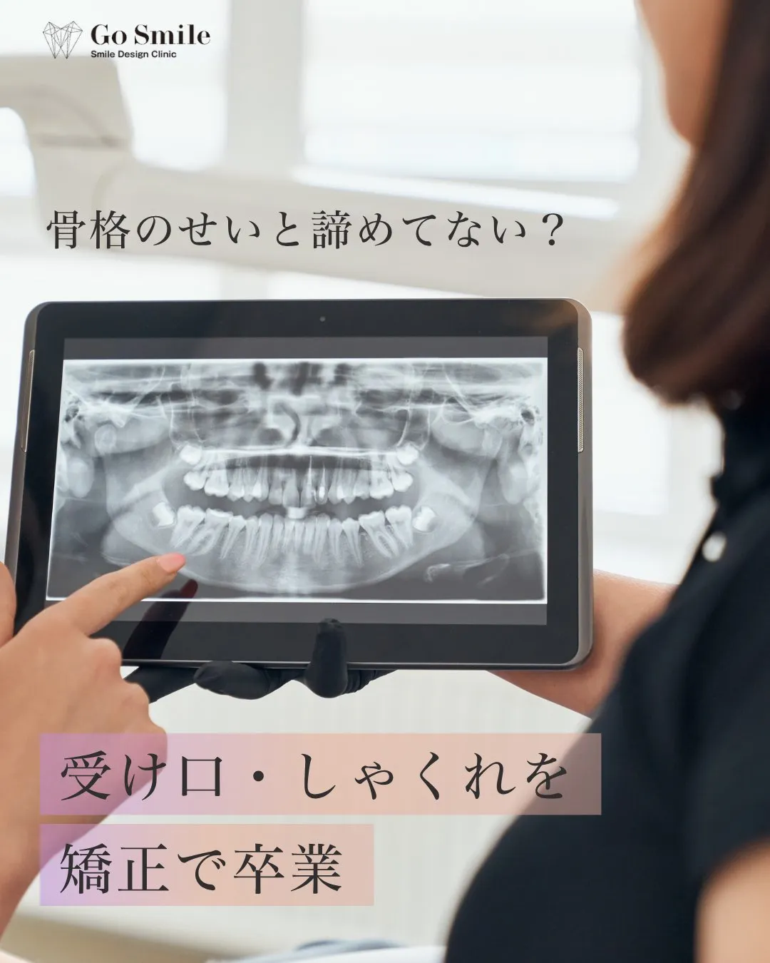 骨格のせいと諦めてない?